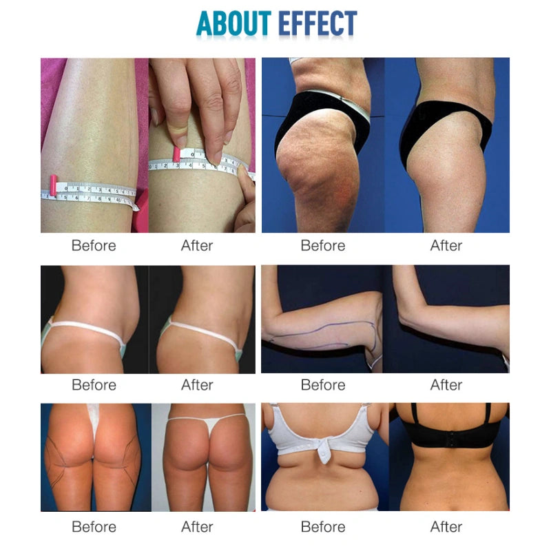 40k+80k Cavitation Slimming System results